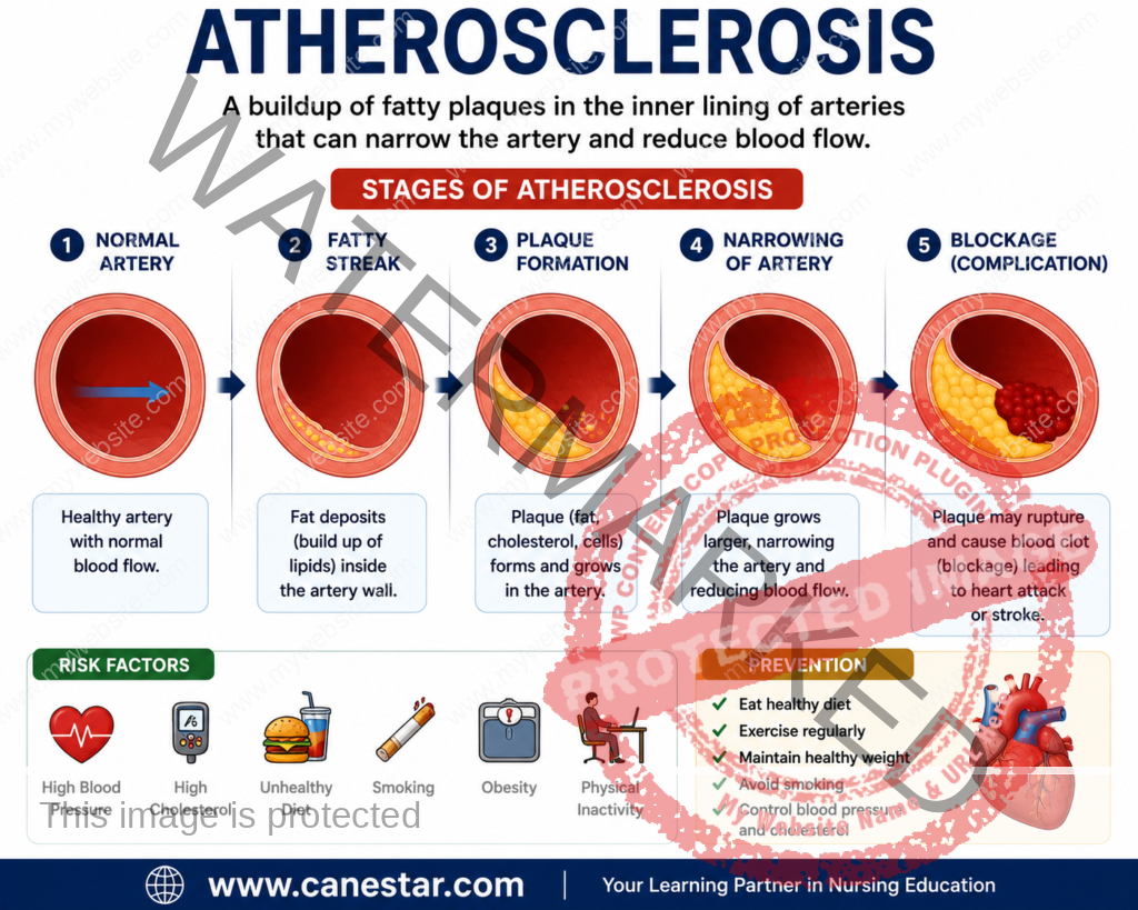 atherosclerosis pathology important questions | www.canestar.com 