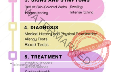 HIVES Urticaria SYMPTOMS