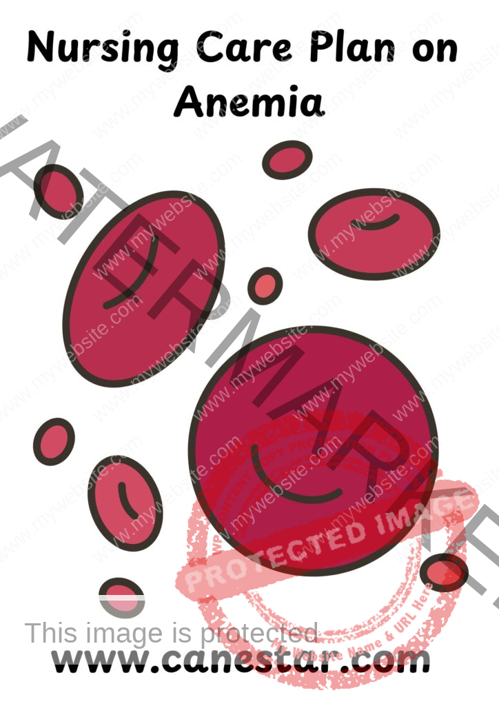 NURSING CARE PLAN FOR ANEMIA